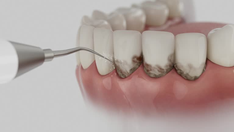 Reliable Dental Implants contractor in Augusta, KS by Smile Center Dentistry